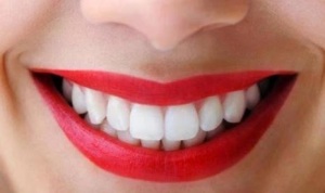 senyum sehat dan gigi kuat
